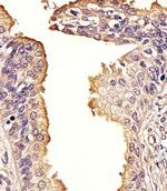 SQSTM1 Antibody in Immunohistochemistry (Paraffin) (IHC (P))