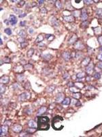 HRD1 Antibody in Immunohistochemistry (Paraffin) (IHC (P))