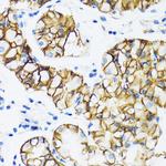 alpha Catenin Antibody in Immunohistochemistry (Paraffin) (IHC (P))