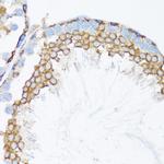 alpha Catenin Antibody in Immunohistochemistry (Paraffin) (IHC (P))