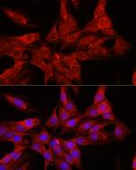 DDX3 Antibody in Immunocytochemistry (ICC/IF)