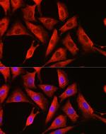 DDX3 Antibody in Immunocytochemistry (ICC/IF)