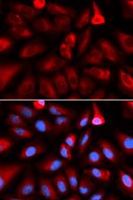 FKBP4 Antibody in Immunocytochemistry (ICC/IF)