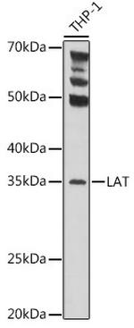 LAT Antibody in Western Blot (WB)