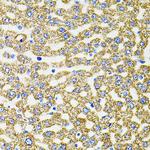 Epo Antibody in Immunohistochemistry (Paraffin) (IHC (P))