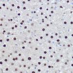 EZH2 Antibody in Immunohistochemistry (Paraffin) (IHC (P))