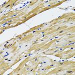 GOT1 Antibody in Immunohistochemistry (Paraffin) (IHC (P))