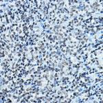 MYST2 Antibody in Immunohistochemistry (Paraffin) (IHC (P))