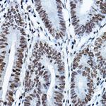 MYST2 Antibody in Immunohistochemistry (Paraffin) (IHC (P))