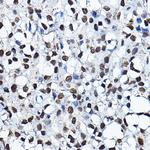 MYST2 Antibody in Immunohistochemistry (Paraffin) (IHC (P))