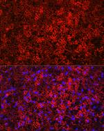 UCP1 Antibody in Immunocytochemistry (ICC/IF)