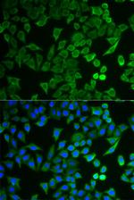 NPRL2 Antibody in Immunocytochemistry (ICC/IF)