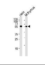 Chk1 Antibody in Western Blot (WB)