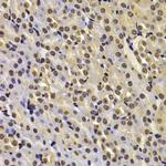 FBXW7 Antibody in Immunohistochemistry (Paraffin) (IHC (P))