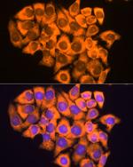 RPL17 Antibody in Immunocytochemistry (ICC/IF)