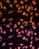 RPL17 Antibody in Immunocytochemistry (ICC/IF)