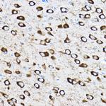 RPL17 Antibody in Immunohistochemistry (Paraffin) (IHC (P))