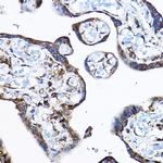 RPL17 Antibody in Immunohistochemistry (Paraffin) (IHC (P))