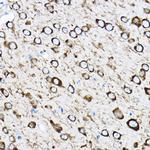 RPL17 Antibody in Immunohistochemistry (Paraffin) (IHC (P))