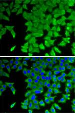 CRABP2 Antibody in Immunocytochemistry (ICC/IF)