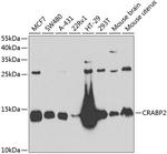 CRABP2 Antibody in Western Blot (WB)