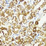 PRAS40 Antibody in Immunohistochemistry (Paraffin) (IHC (P))