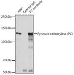 Pyruvate Carboxylase Antibody in Immunoprecipitation (IP)