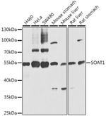 SOAT1 Antibody in Western Blot (WB)