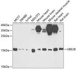 UBE2B Antibody in Western Blot (WB)