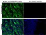 Synaptophysin Antibody in Immunohistochemistry (Paraffin) (IHC (P))