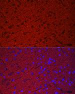 Synaptophysin Antibody in Immunohistochemistry (Paraffin) (IHC (P))