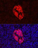 Synaptophysin Antibody in Immunohistochemistry (Paraffin) (IHC (P))