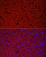 Synaptophysin Antibody in Immunohistochemistry (Paraffin) (IHC (P))