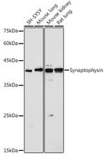 Synaptophysin Antibody in Western Blot (WB)