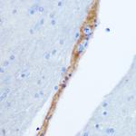 GRP Antibody in Immunohistochemistry (Paraffin) (IHC (P))