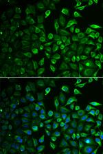 IMPA1 Antibody in Immunocytochemistry (ICC/IF)