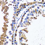 IMPA1 Antibody in Immunohistochemistry (Paraffin) (IHC (P))