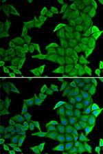 SMYD2 Antibody in Immunocytochemistry (ICC/IF)