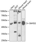 SMYD2 Antibody in Western Blot (WB)