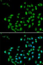 CTNNBL1 Antibody in Immunocytochemistry (ICC/IF)