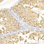 KIF3A Antibody in Immunohistochemistry (Paraffin) (IHC (P))