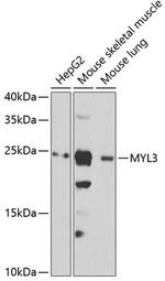 MYL3 Antibody in Western Blot (WB)