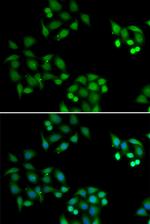 NSFL1C Antibody in Immunocytochemistry (ICC/IF)