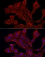 PIK3CG Antibody in Immunocytochemistry (ICC/IF)