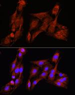 PSAT1 Antibody in Immunocytochemistry (ICC/IF)