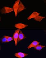 PSAT1 Antibody in Immunocytochemistry (ICC/IF)