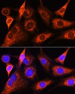 PSAT1 Antibody in Immunocytochemistry (ICC/IF)