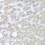 Sorcin Antibody in Immunohistochemistry (Paraffin) (IHC (P))