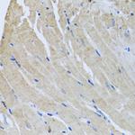 Sorcin Antibody in Immunohistochemistry (Paraffin) (IHC (P))