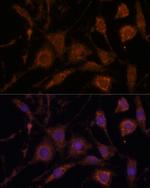 STC1 Antibody in Immunocytochemistry (ICC/IF)